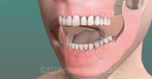 3D Graphic Image Dental